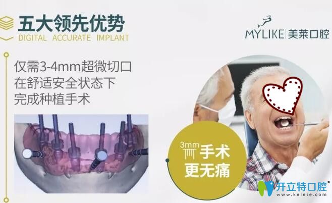 深圳美萊口腔3D顯微精準(zhǔn)種植牙5大優(yōu)勢