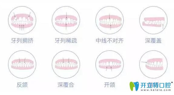 成人牙齒矯正會(huì)反彈嗎