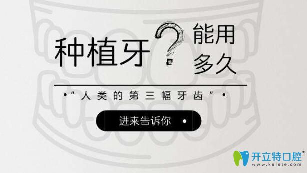 銘德口腔繆思亮告訴你：種植牙大部分壽命是多久