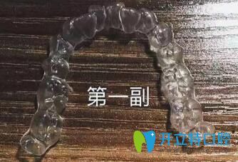 我在煙臺(tái)百仕口腔戴的頭一副隱形牙套 我在煙臺(tái)百仕口腔戴的頭一副隱形牙套