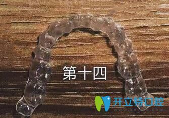 我在煙臺(tái)百仕口腔戴的時(shí)代天使隱形牙套 我在煙臺(tái)百仕口腔戴的時(shí)代天使隱形牙套