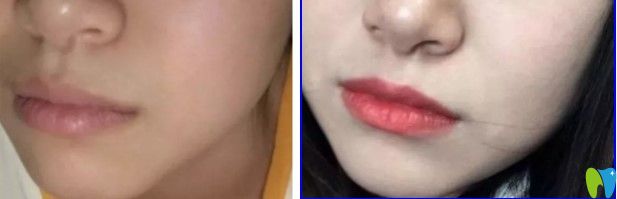 20190816509227.jpg 20190816509227.jpg