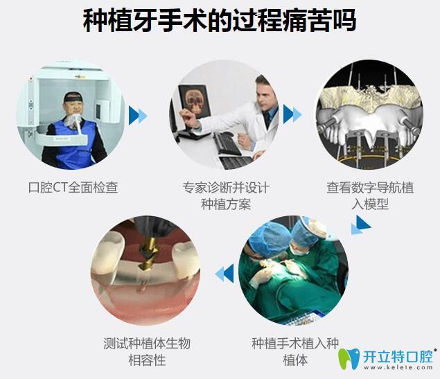 北京瑞鯊口腔吳志強醫(yī)生告訴你種植牙手術(shù)疼嗎