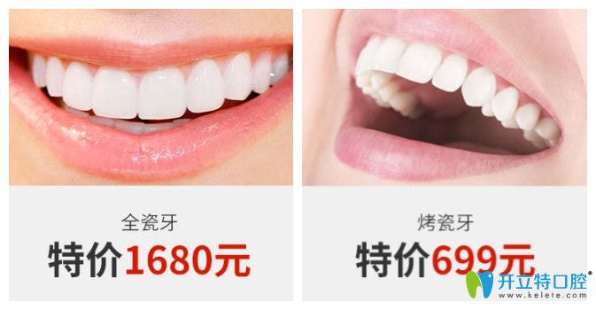 正夫口腔全瓷牙和烤瓷牙價格圖示