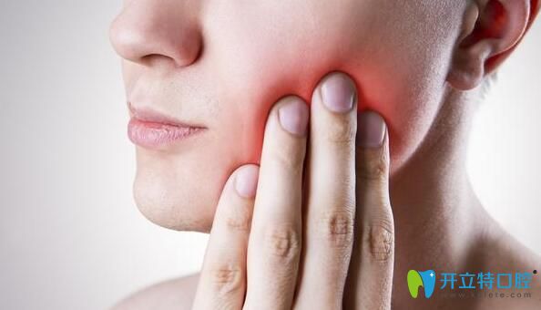 牙周炎會(huì)遺傳嗎