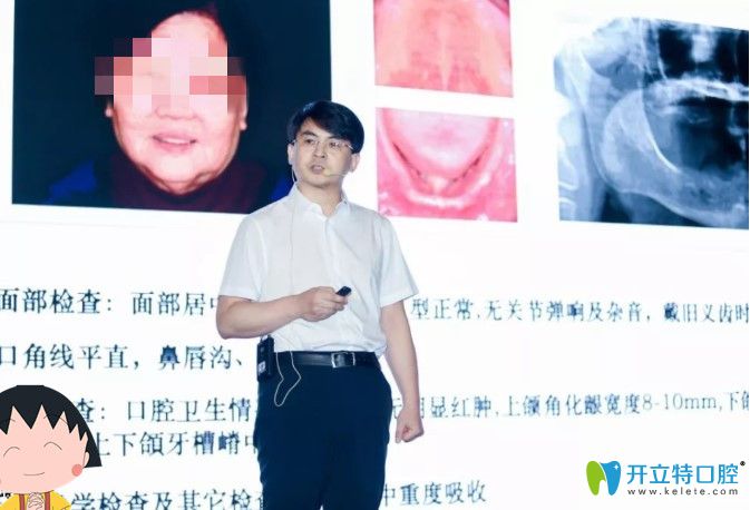 維樂(lè)口腔時(shí)紹忠院長(zhǎng)分享全口無(wú)牙頜種植案例圖示