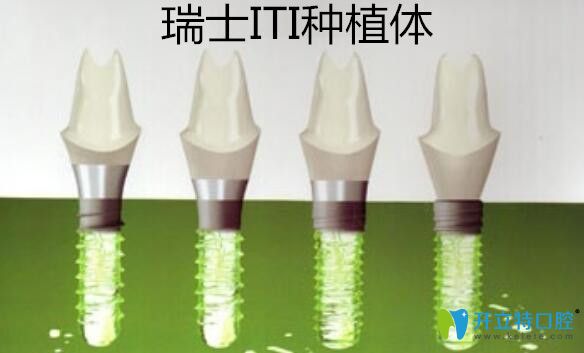 告訴你如何辨別瑞士iti種植體的真假,讓你做種植牙不上當
