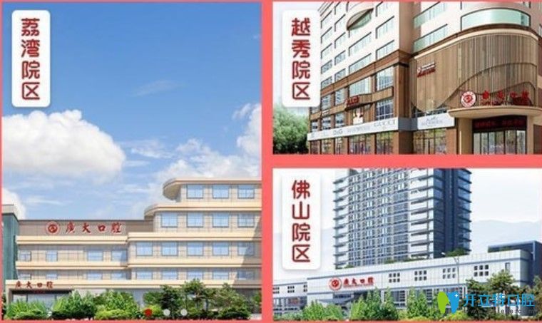 廣州廣大比較全的牙齒矯正價格來啦,含傳統(tǒng)矯正和隱形矯正