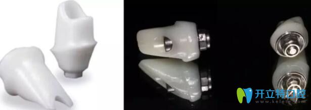 種植牙全瓷基臺