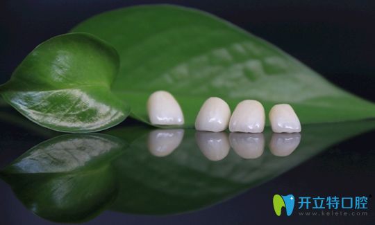 鈀金烤瓷牙和全瓷牙選哪個更好呢