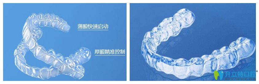 時(shí)代天使隱形牙套圖示