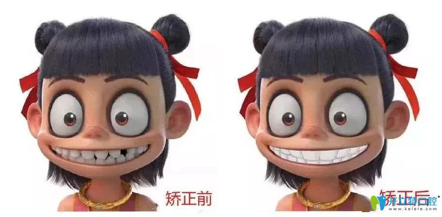 快看深圳韋博口腔暑期特惠活動(dòng),學(xué)生牙齒矯正價(jià)格才5500元起