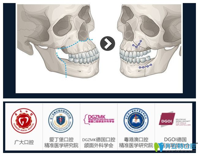 V-LINE正領(lǐng)聯(lián)合變臉術(shù)