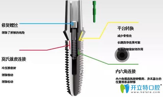 意大利BB種植系統(tǒng)