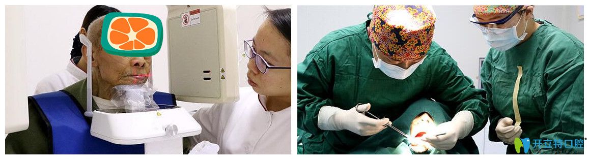 侯主任為韓老實施精準種植手術(shù)圖