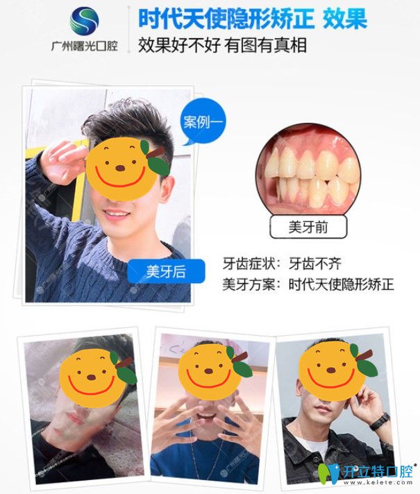 曙光口腔22周年到院五重好禮