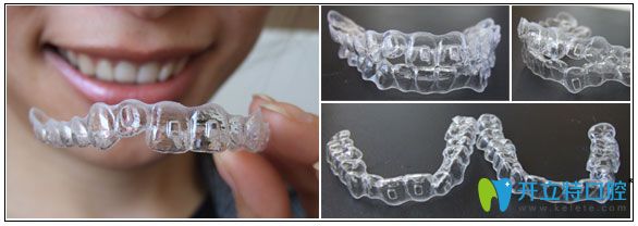 北京瑞鯊口腔張嘉熙醫(yī)生介紹時(shí)代天使雙模和單模的區(qū)別