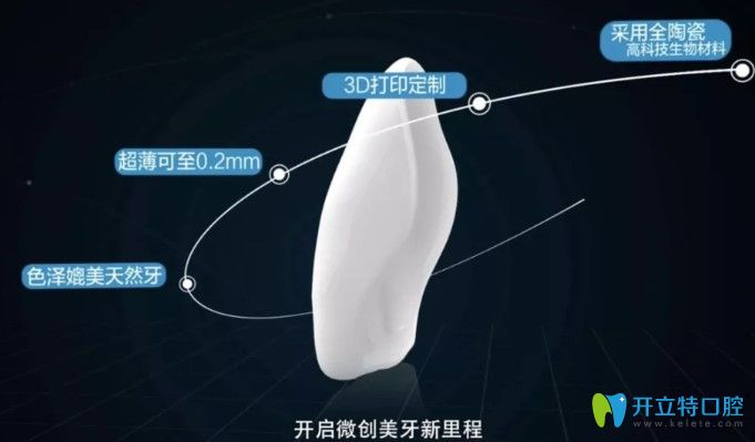 剛開始做的牙齒貼面很失敗，又進行了二次瓷貼面修復