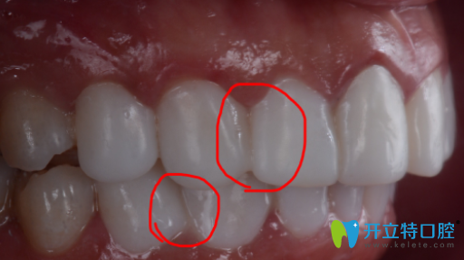 瓷貼面沒有縫隙