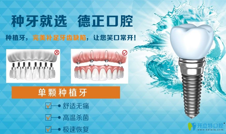 鄭州德正口腔單顆牙種植優(yōu)勢(shì)