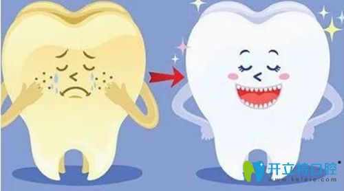 美加牙貼面和義獲嘉牙齒貼面選哪個更好