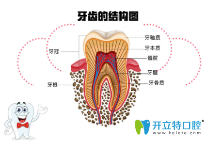 怎么判斷要做根管治療？齲齒傷到牙神經(jīng)的標志