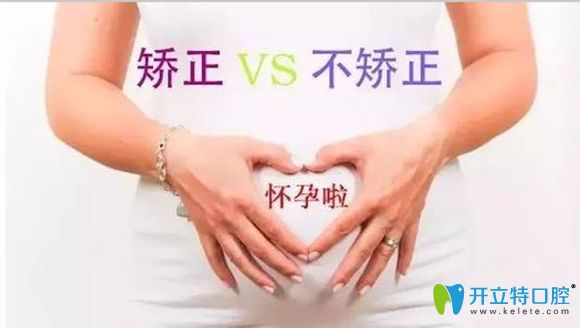 做正畸中途懷孕還好辦,那剛戴牙套20天懷孕了,整牙要繼續(xù)嗎