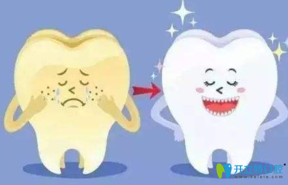 皓齒美白和冷光美白哪個好？看到分別多少錢后我懂了