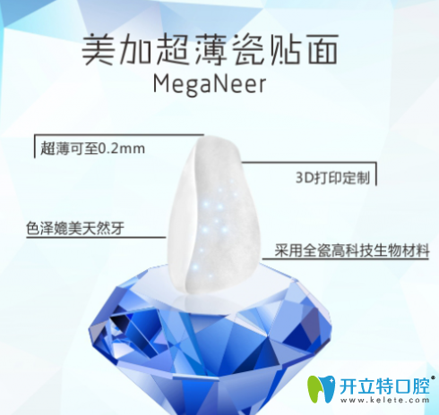 揭開美加超薄貼面的壽命及真的不要磨牙嗎的真相