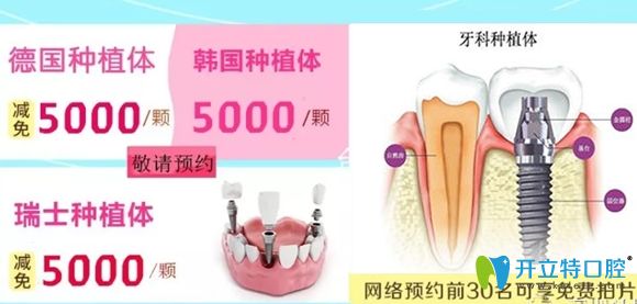 美佳德口腔做種植牙網絡預約前30名可享免費拍片