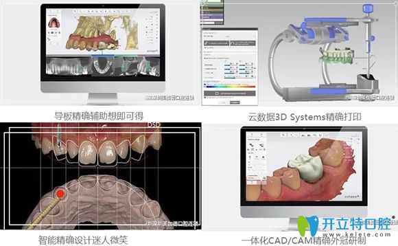 美佳德口腔全流程實(shí)現(xiàn)了數(shù)字化科技口腔診療服務(wù) 美佳德口腔全流程實(shí)現(xiàn)了數(shù)字化科技口腔診療服務(wù)