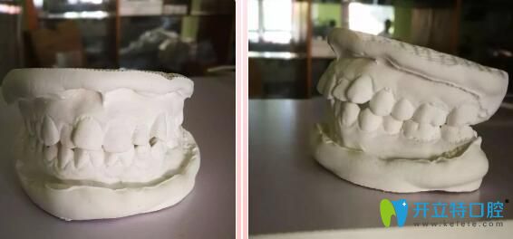 我在靖江艾齒嘉口腔的牙膜