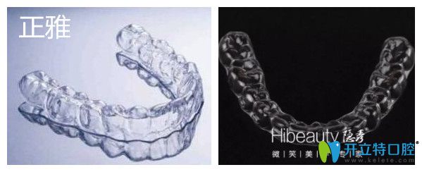 探訪:國產(chǎn)隱形牙齒矯正器中隱秀和正雅隱形牙套的區(qū)別
