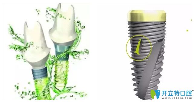 同是瑞士品牌：百丹特和iti種植牙哪個好價格更便宜