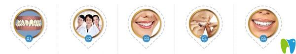 美奧口腔的5大矯正特色