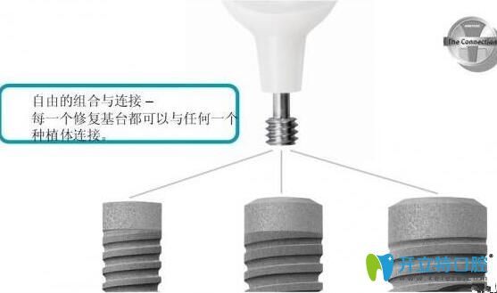 德國ankylos種植系統(tǒng)基臺特點(diǎn)