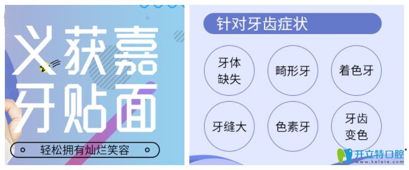 康美口腔義獲嘉超薄牙貼面使用癥狀