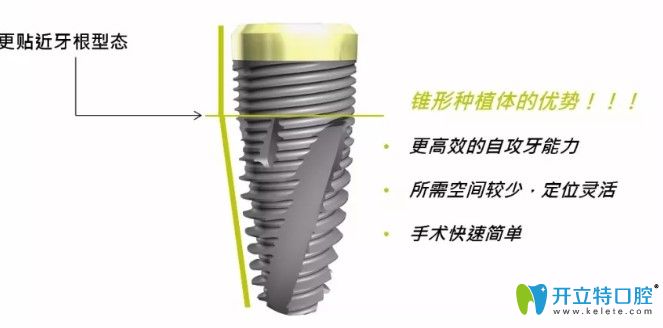 瑞士百丹特種植體的優(yōu)勢