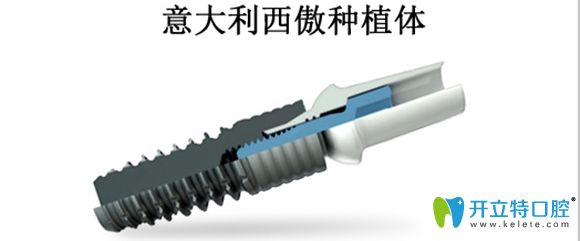 西傲種植體獨(dú)特的設(shè)計(jì)能減少牙槽骨的創(chuàng)傷