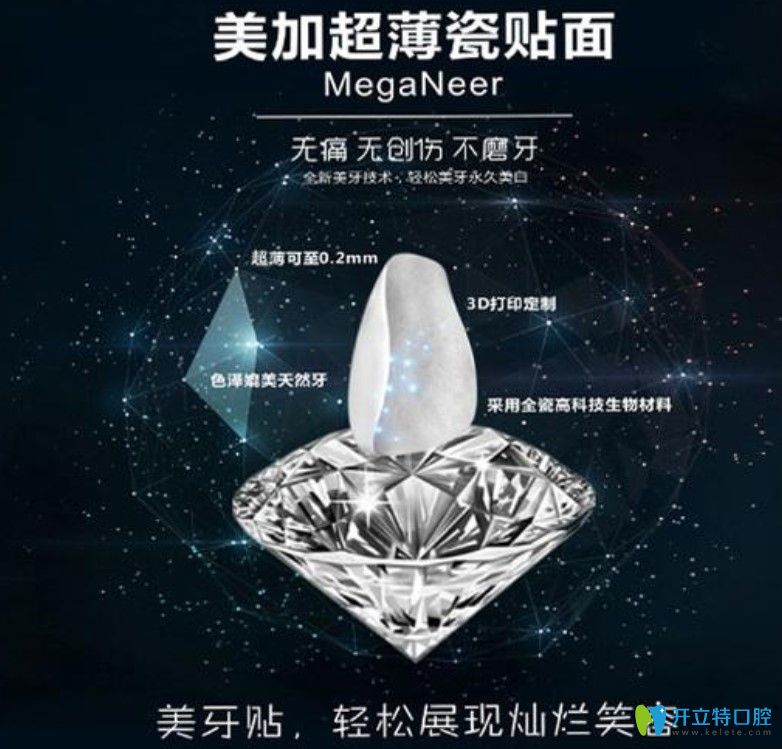 <!--<i data=20240703-sp></i>-->兵解析美加超薄牙貼面使用壽命