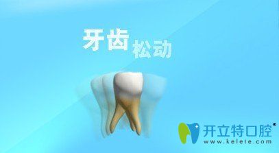 牙齒松了可以固定嗎,那些問牙齒松了怎么拔的人怎么想的？