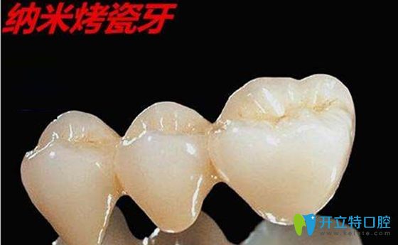 納米烤瓷牙價(jià)格多少錢