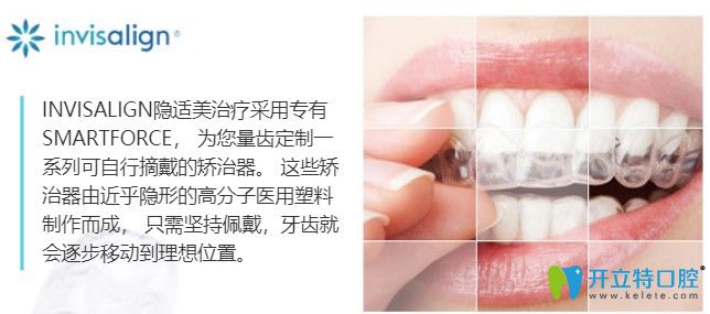 南通康美口腔的隱適美隱形矯正技術(shù)