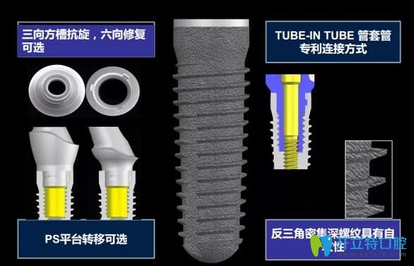 CAMLOG德國種植體怎么樣