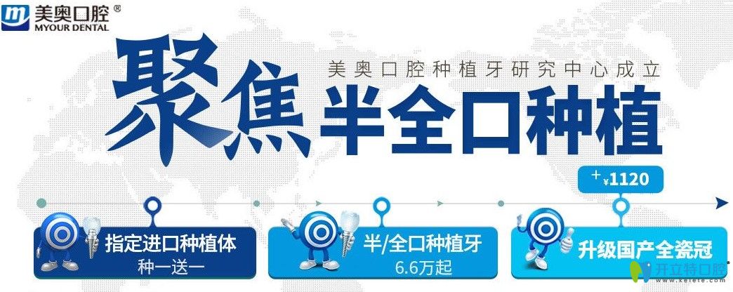 超劃算！杭州美奧口腔美國皓圣和法國安卓健都是種1送1吶