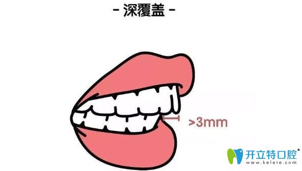 深覆蓋何不趁著康美做活動矯正走起來