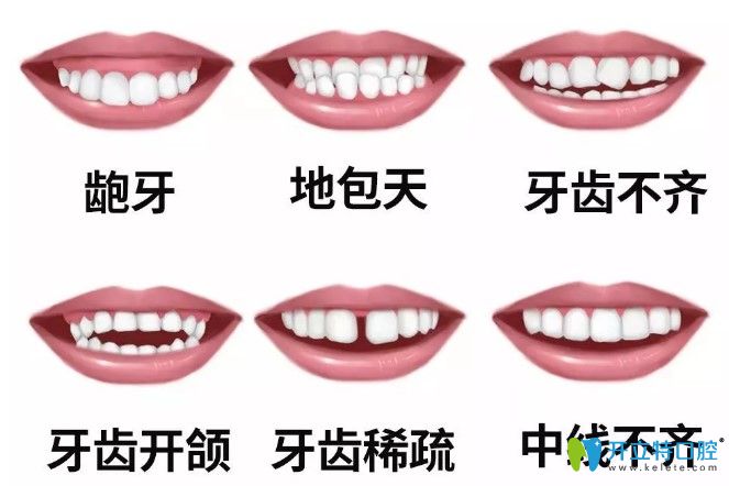 中秋不妨趁著維樂口腔牙齒矯正價(jià)格優(yōu)惠來做正畸