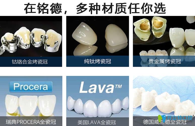 深圳銘德口腔牙齒美白材料多樣化