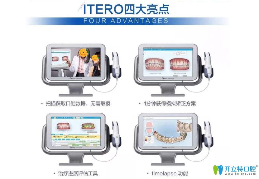 在維樂口腔可以免費(fèi)體驗(yàn)iTero口掃