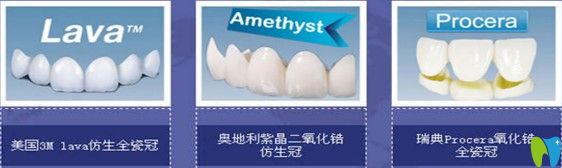 不同烤瓷牙的對(duì)比圖